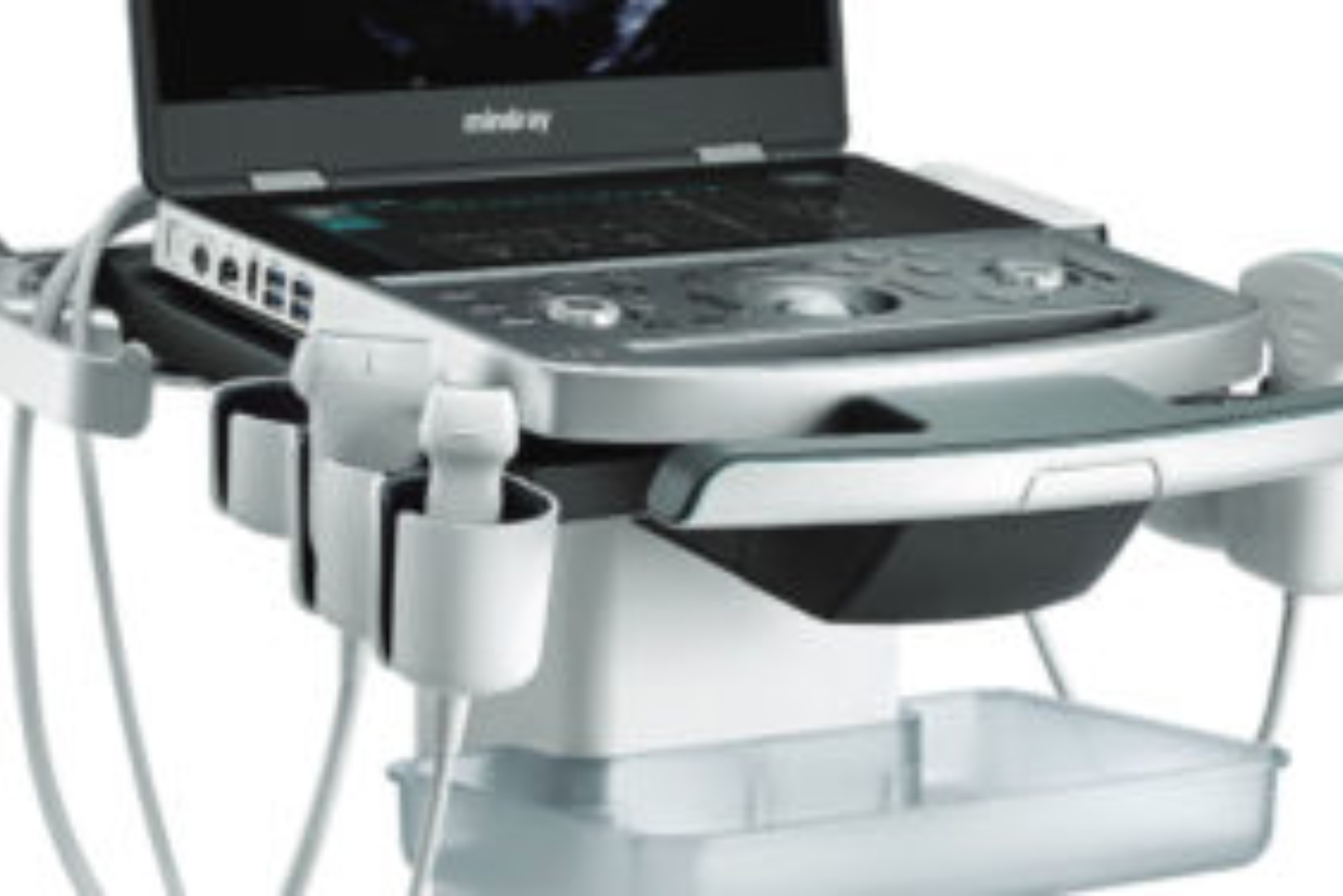 Revolutionizing Healthcare with Edan's Portable Ultrasound Machines