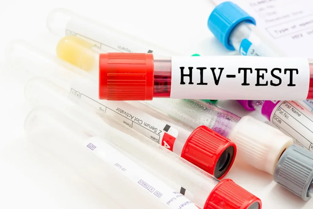 Significance of HIV Testing in Dubai
