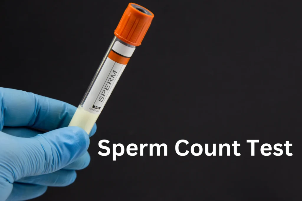 Sperm Count Test