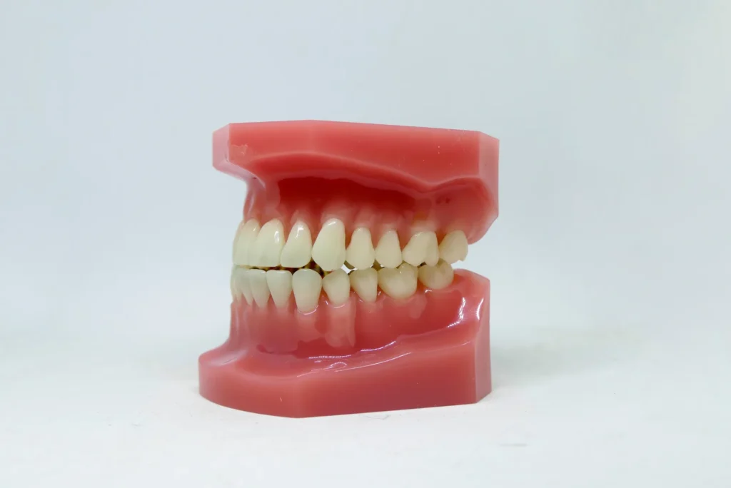 All-On-6 Dental Implants Dubai - Superior Full-Arch Support