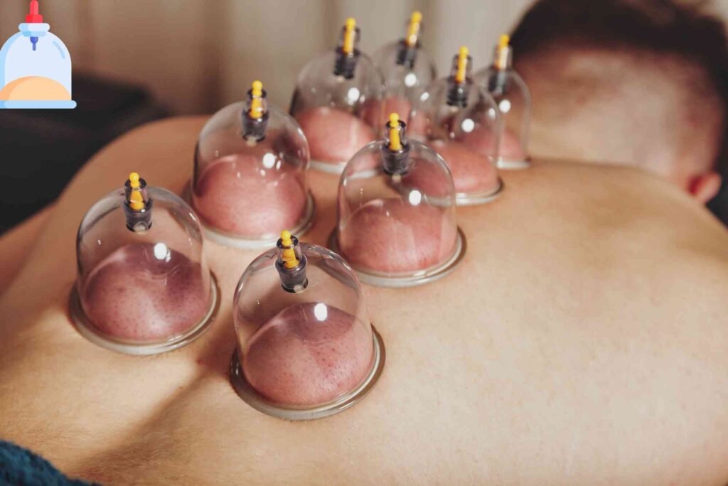Do Home Massage Services in Dubai Offer Cupping Therapy